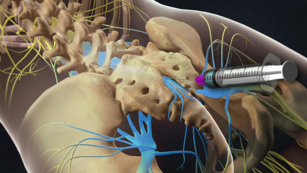 Interventional Pain Center Services Saspine Surgical Associates In Spine